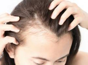 5 лучших косметических процедур при выпадении волос