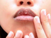 6 способов узнать о вашем здоровье по губам