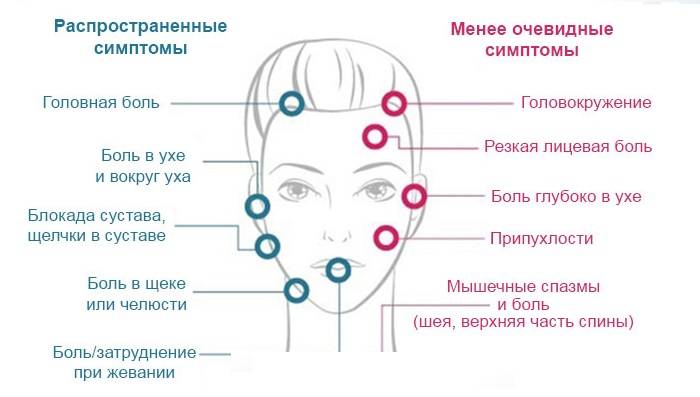 Симптомы дисфункции ВНЧС