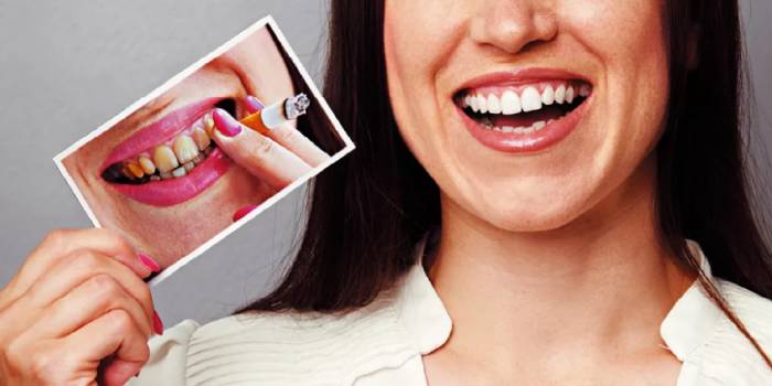 Отбеливание для зубов для курящих отбеливание зубов екатеринбург зум