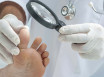 Какой врач лечит грибок ногтей на ногах