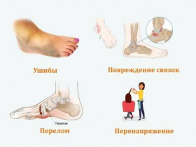 7 причин боли в ногах, из-за которых вы не сможете ходить