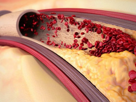 Какой должен быть холестерин после 50 лет - норма для мужчин и женщин