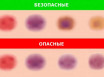 О чем вам может рассказать цвет синяка