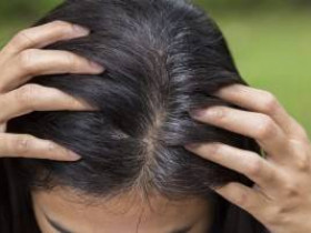 Что вызывает седые волосы в раннем возрасте