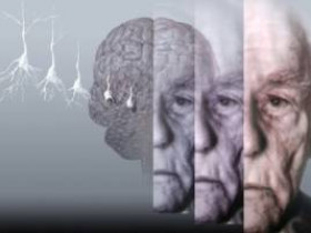 Как здоровый образ жизни снижает риск болезни Альцгеймера