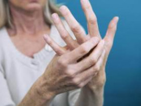 6 удивительных признаков артрита
